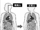 温州男子五脏六腑都反着长 自称“我是镜面人”