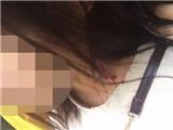 高楼飞下三把刀 温州一女孩头部被砸中鲜血直流